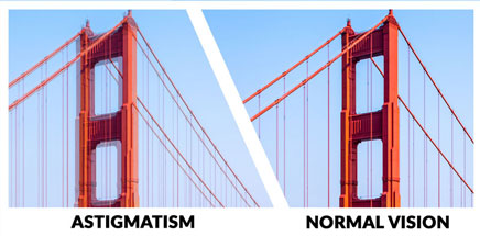 Astigmatism Vs. Normal eyesight illustration comparison