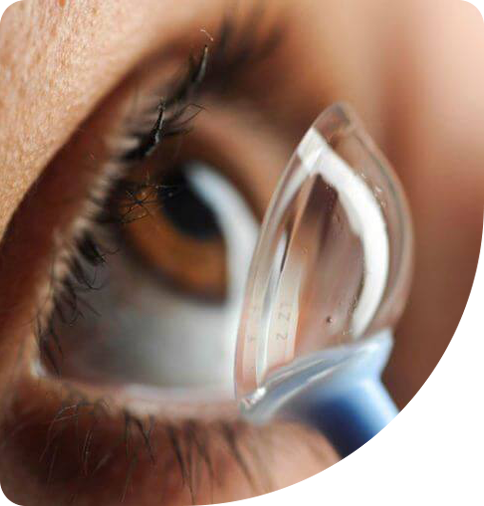 Scleral Lenses