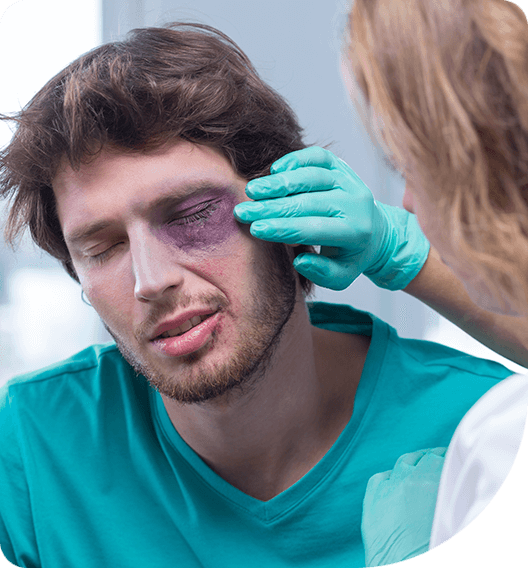 Man with a black eye getting treated by a doctor